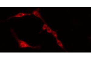 ABIN6274384 staining HeLa cells by IF/ICC. (PFKFB3 anticorps)