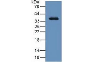 WB of Protein Standard: different control antibodies  against Highly purified E. (LRG1 Kit ELISA)