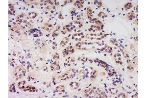 Formalin-fixed and paraffin embedded human kidney labeled with Anti-Caspase-6 (NT) Polyclonal Antibody, Unconjugated  at 1:500 followed by conjugation to the secondary antibody and DAB staining. (Caspase 6 anticorps  (AA 27-130))