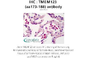 Image no. 1 for anti-Transmembrane Protein 123 (TMEM123) (AA 173-188) antibody (ABIN1740149) (TMEM123 anticorps  (AA 173-188))