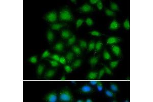 Immunofluorescence analysis of HeLa cells using MXI1 Polyclonal Antibody (MXI1 anticorps)
