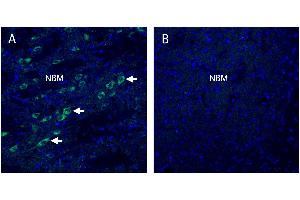 Stromal interaction molecule 2 (STIM2) in mouse nucleus basalis (NBM) regionA. (Stim2 anticorps  (Intracellular))