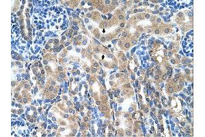 Immunohistochemistry (IHC) image for anti-Amiloride Binding Protein 1 (Amine Oxidase (Copper-Containing)) (ABP1) (C-Term) antibody (ABIN2777059)