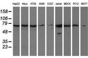 Western blot analysis of extracts (35 µg) from 9 different cell lines by using anti-HAO1 monoclonal antibody. (HAO1 anticorps)