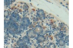 Detection of PON1 in Rat Pancreas Tissue using Polyclonal Antibody to Paraoxonase 1 (PON1)