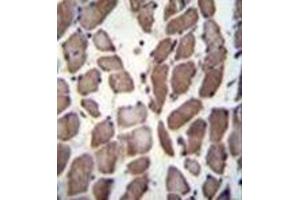 Immunohistochemistry analysis in formalin fixed and paraffin embedded human skeletal muscle reacted with LRP12 / ST7 Antibody (C-term) followed which was peroxidase conjugated to the secondary antibody and DAB staining.