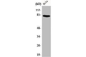 Western Blot analysis of HeLa cells using Catenin-γ Polyclonal Antibody (JUP anticorps  (C-Term))