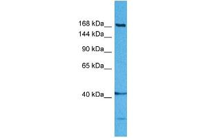 Host:  Rabbit  Target Name:  DISP1  Sample Tissue:  Human MDA-MB-435s Whole Cell  Antibody Dilution:  1ug/ml (DISP1 anticorps  (Middle Region))