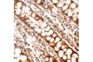 Immunohistochemistry of Periphilin in human colon tissue with Periphilin antibody at 2. (PPHLN1 anticorps  (Middle Region))