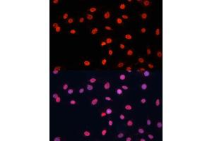 Immunofluorescence analysis of C6 cells using FUS antibody (ABIN6127938, ABIN6140818, ABIN6140819 and ABIN7101788) at dilution of 1:100. (FUS anticorps  (AA 297-526))