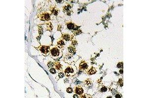 Immunohistochemical analysis of STAG3 staining in human testis formalin fixed paraffin embedded tissue section.