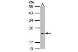 Image no. 1 for anti-S-Phase Kinase-Associated Protein 1 (SKP1) (AA 1-110) antibody (ABIN1500945) (SKP1 anticorps  (AA 1-110))