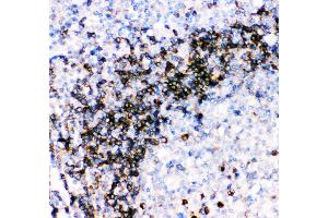 Anti- CD79A picoband antibody, IHC(P) IHC(P): Human Tonsil Tissue (CD79a anticorps  (AA 121-226))