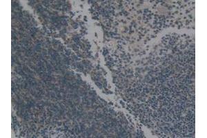 Detection of Hsp60 in Mouse Spleen Tissue using Polyclonal Antibody to Heat Shock Protein 60 (Hsp60)