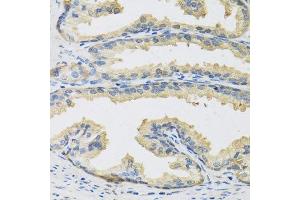 Immunohistochemistry of paraffin-embedded human prostate using CST3 antibody. (CST3 anticorps  (AA 27-146))