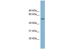 CHST1 antibody used at 1 ug/ml to detect target protein. (CHST1 anticorps)