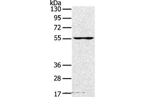 Western blot analysis of PC3 cell, using UBP1 Polyclonal Antibody at dilution of 1:200 (UBP1 anticorps)