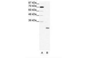 Image no. 1 for anti-Inhibitor of DNA Binding 4, Dominant Negative Helix-Loop-Helix Protein (ID4) (N-Term) antibody (ABIN202035) (ID4 anticorps  (N-Term))