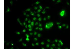Immunofluorescence analysis of U2OS cells using NELFE antibody (ABIN6127279, ABIN6144527, ABIN6144529 and ABIN6222777).