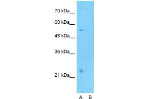 Host:  Rabbit  Target Name:  CD40LG  Sample Type:  Human Fetal Muscle  Lane A:  Primary Antibody  Lane B:  Primary Antibody + Blocking Peptide  Primary Antibody Concentration:  1ug/ml  Peptide Concentration:  5ug/ml  Lysate Quantity:  25ug/lane/lane  Gel Concentration:  0.