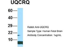 Host: Rabbit  Target Name: UQCRQ  Sample Tissue: Human Fetal Brain  Antibody Dilution: 1.