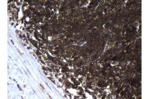 Image no. 2 for anti-Coiled-Coil Domain Containing 93 (CCDC93) (AA 293-631) antibody (ABIN1491348)