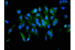 Immunofluorescence staining of Hela cells with ABIN7166409 at 1:133, counter-stained with DAPI. (Transglutaminase 2 anticorps  (AA 4-544))