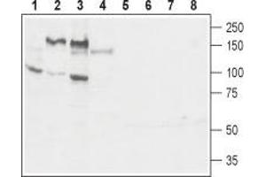 Western blot analysis of mouse brain membrane (lanes 1 and 5), rat brain lysate (lanes 2 and 6), rat brain membrane (lanes 3 and 7) and rat uterus lysate (lanes 4 and 8): - 1-3.
