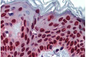 Human Skin (formalin-fixed, paraffin-embedded) stained with SLC35A5 antibody ABIN462241 followed by biotinylated goat anti-rabbit IgG secondary antibody ABIN481713, alkaline phosphatase-streptavidin and chromogen. (SLC35A5 anticorps  (AA 36-85))