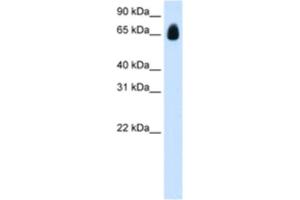 Western Blotting (WB) image for anti-Tripartite Motif Containing 32 (TRIM32) antibody (ABIN2461828) (TRIM32 anticorps)