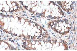 Immunohistochemistry of paraffin-embedded Human colon using Aquaporin 4 Polyclonal Antibody at dilution of 1:100 (40x lens). (Aquaporin 4 anticorps)