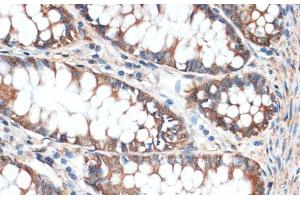 Immunohistochemistry of paraffin-embedded Human colon using Aquaporin 4 Polyclonal Antibody at dilution of 1:100 (40x lens).
