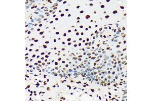 Immunohistochemistry of paraffin-embedded human esophageal using U/DDX39B Rabbit mAb (ABIN7266696) at dilution of 1:100 (40x lens).