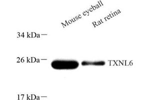 Western blot analysis of TXNL6 (ABIN7074917) at dilution of 1: 500 (NXNL1 anticorps)