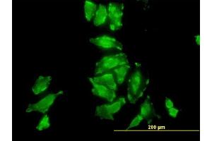Immunofluorescence of monoclonal antibody to PSMD10 on HeLa cell.