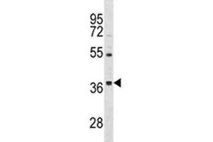 ORAI3 antibody western blot analysis in HepG2 lysate. (ORAI3 anticorps  (AA 1-30))