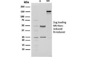SDS-PAGE Analysis Purified CHD4 Mouse Monoclonal Antibody (3F2/4).