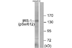 Western blot analysis of extracts from HUVEC cells, treated with insulin (0. (IRS1 anticorps  (pSer612))