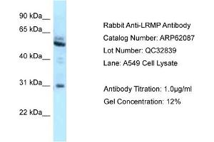 Western Blotting (WB) image for anti-Lymphoid-Restricted Membrane Protein (LRMP) (C-Term) antibody (ABIN2789013)