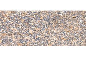 Immunohistochemistry of paraffin-embedded Human tonsil tissue using TEAD3 Polyclonal Antibody at dilution of 1:50(x200)