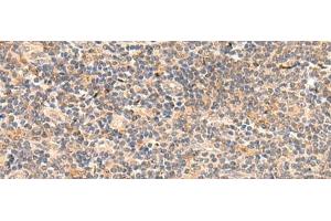 Immunohistochemistry of paraffin-embedded Human tonsil tissue using TEAD3 Polyclonal Antibody at dilution of 1:50(x200) (TEAD3 anticorps)