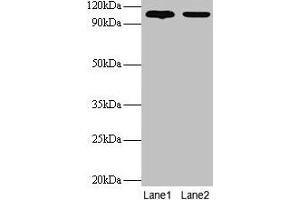 Western blot All lanes: EXTL3 antibody at 2 μg/mL Lane 1: EC109 whole cell lysate Lane 2: 293T whole cell lysate Secondary Goat polyclonal to rabbit IgG at 1/15000 dilution Predicted bane side: 105 kDa Observed band side: 105 kDa (EXTL3 anticorps  (AA 2-245))