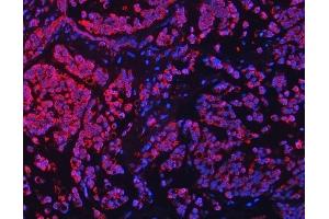 IF analysis of TFEB using anti-TFEB antibody (ABIN7600648).