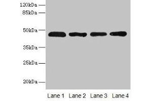 Western blot All lanes: ZDHHC23 antibody at 8 μg/mL Lane 1: 293T whole cell lysate Lane 2: Mouse brain tissue Lane 3: A549 whole cell lysate Lane 4: Human placenta tissue Secondary Goat polyclonal to rabbit IgG at 1/10000 dilution Predicted band size: 46 kDa Observed band size: 46 kDa