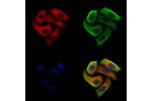 ABIN7094421 and ABIN7098468 staining Hela cells by IF/ICC. (Clathrin anticorps  (C-Term))