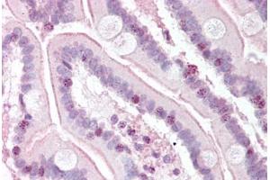 Human Small Intestine (formalin-fixed, paraffin-embedded) stained with RTEL1 antibody ABIN334244 at 5 ug/ml followed by biotinylated goat anti-rabbit IgG secondary antibody ABIN481713, alkaline phosphatase-streptavidin and chromogen. (RTEL1 anticorps  (N-Term))