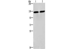 Gel: 6 % SDS-PAGE, Lysate: 40 μg, Lane 1-2: PC3 cells, lovo cells, Primary antibody: ABIN7128916(CEP97 Antibody) at dilution 1/750, Secondary antibody: Goat anti rabbit IgG at 1/8000 dilution, Exposure time: 3 seconds (CEP97 anticorps)