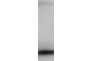 Western Blot of Rabbit Anti-PIP5K2B Antibody.