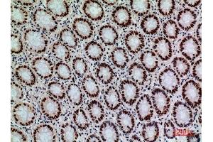 Immunohistochemistry (IHC) analysis of paraffin-embedded Human Colon, antibody was diluted at 1:100.