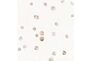 anti-Tweety Homolog 1 (TTYH1) (C-Term) antibody